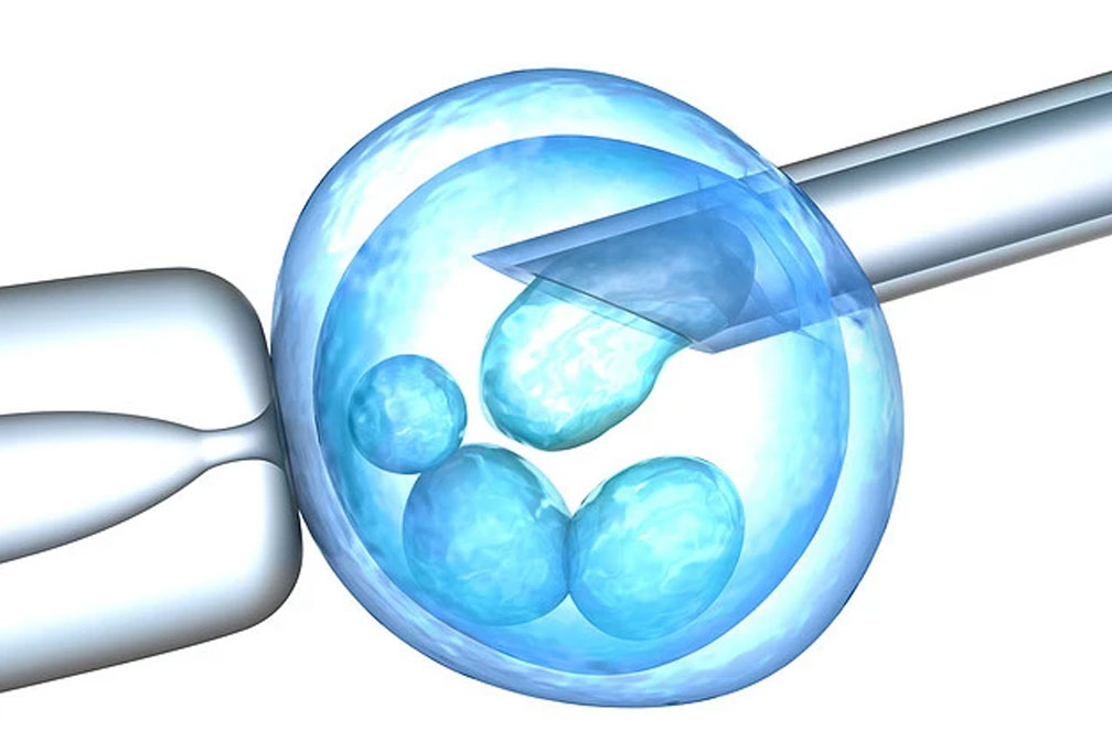 泰國DHC做試管嬰兒的確是有并發(fā)癥的！