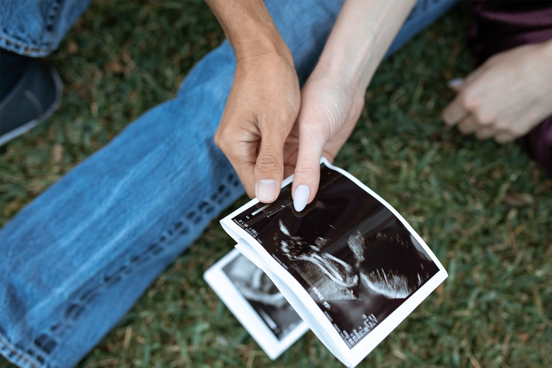 夫婦通過基因篩查生出健康寶寶 夫婦通過基因篩查生出健康寶寶