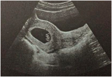 圖片3_50%.png 圖片3_50%.png