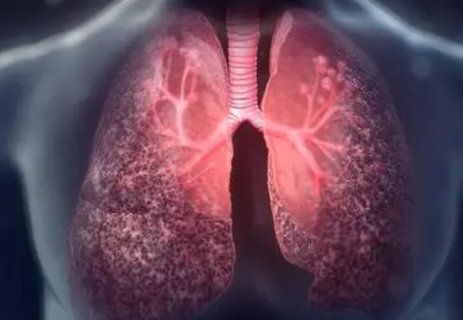 囊性纖維化會遺傳給后代嗎？囊性纖維化遺傳方式