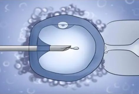 無精癥怎么恢復(fù)生精功能？無精癥的調(diào)理治療方法