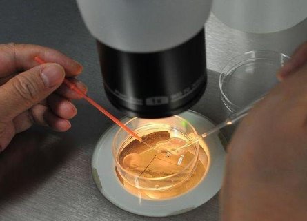 試管嬰兒適合哪些人群？試管嬰兒的適用范圍