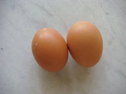 睪丸囊腫會自己消失嗎？了解其自然進(jìn)程與治療選項