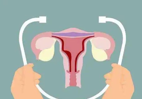 TCT檢查報(bào)告單怎么看？TCT檢查的意義和作用