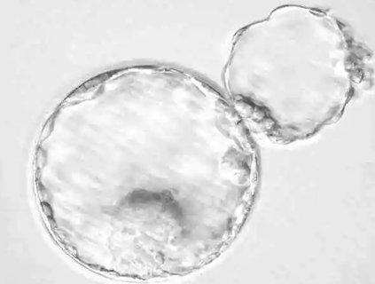 輔助孵化能提高成功率嗎？揭秘輔助孵化技術(shù)的影響