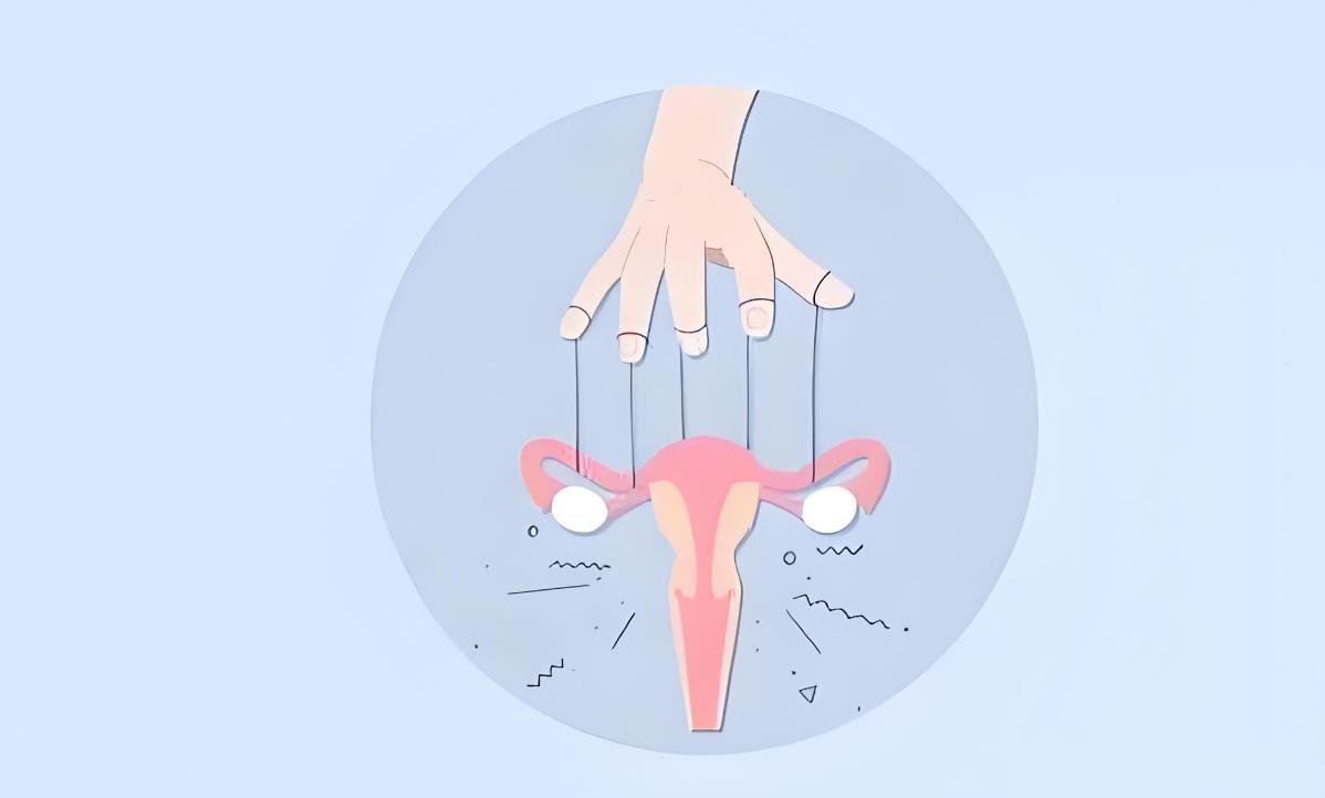 幼稚型子宮 幼稚型子宮