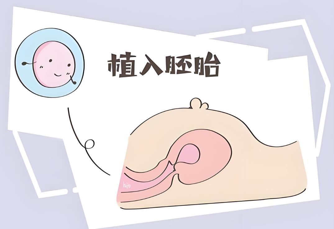 胚胎移植 胚胎移植