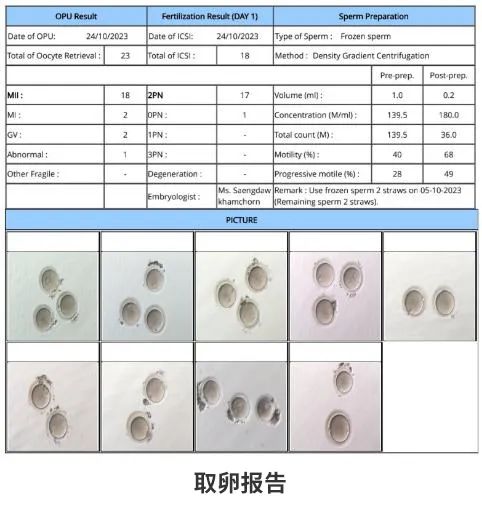取卵報(bào)告 取卵報(bào)告