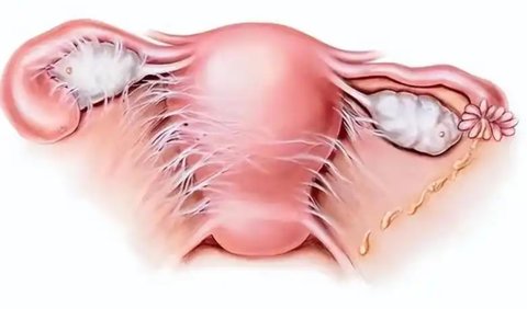 宮腔粘連對(duì)移植有影響嗎？宮腔粘連對(duì)試管嬰兒移植的影響