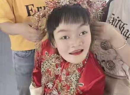 腦癱女孩嫁唐氏丈夫！問題父母能否生出健康孩子？