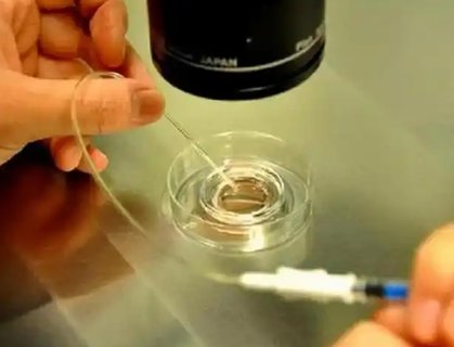 三代試管可以避免畸形嗎？避免畸形的希望與現(xiàn)實