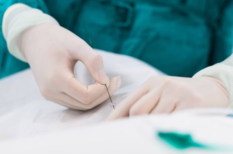 試管減胎對(duì)另一個(gè)有影響嗎？對(duì)另一胎兒的潛在影響