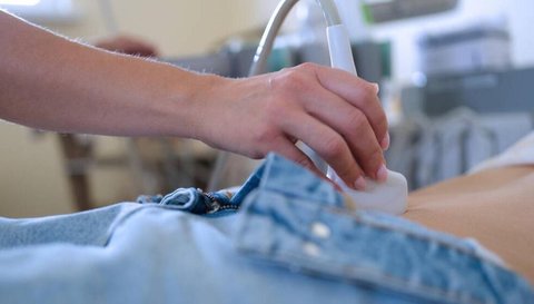 試管一超二超三超都是陰超嗎？了解最佳選擇