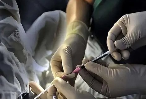 去泰國做試管流程是怎樣的？泰國試管的詳細(xì)過程