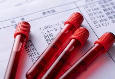 β人絨毛膜促性腺激素多少是懷孕？懷孕的標(biāo)志