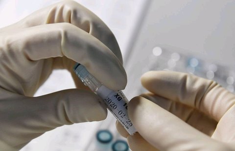 脂聯(lián)素偏低是什么原因怎么調(diào)理？調(diào)理策略分析