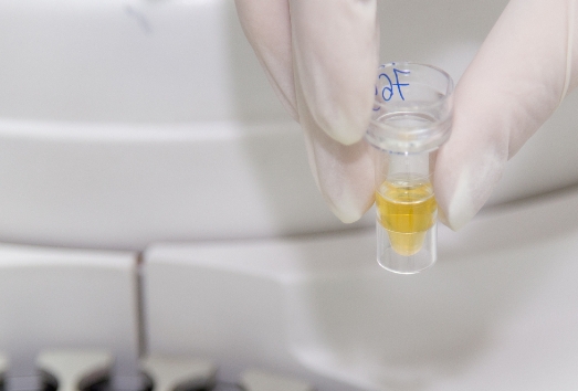 重慶試管嬰兒費用大約多少？2025重慶費用分析