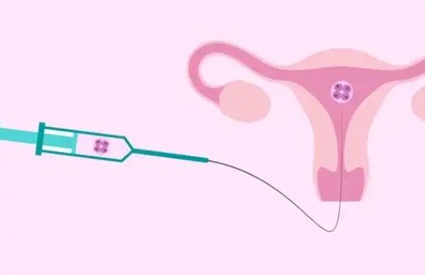 宮腔灌注治療一次需要多少錢？宮腔灌注治療費(fèi)用解析