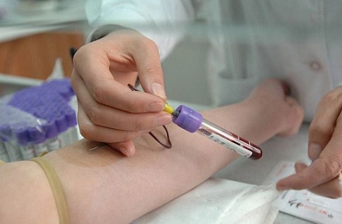 激素六項(xiàng)檢查多少錢(qián)？激素六項(xiàng)檢查收費(fèi)標(biāo)準(zhǔn)