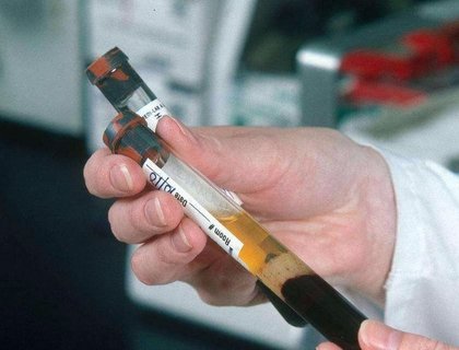 杭州試管嬰兒費(fèi)用大概要多少錢(qián)？杭州試管嬰兒費(fèi)用全解析