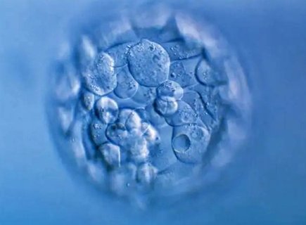 試管嬰兒要準(zhǔn)備多少錢？中美泰三國(guó)費(fèi)用對(duì)比