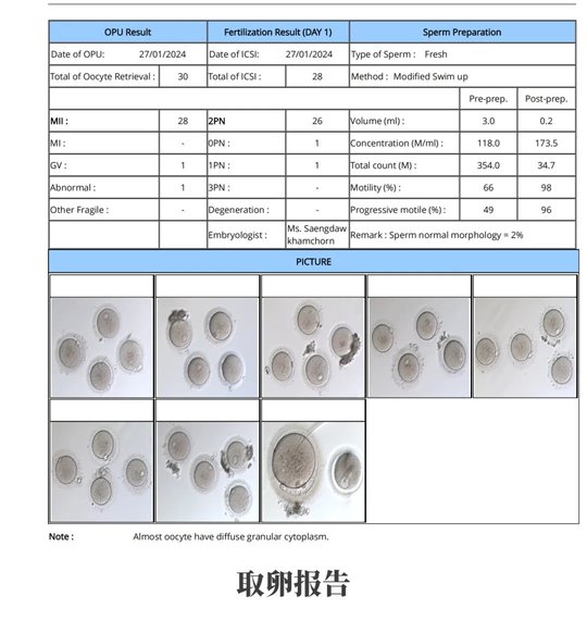 從絕望到希望：多囊卵巢患者6年艱辛求子，終在DHC圓滿！